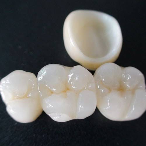 Zirconium Crowns